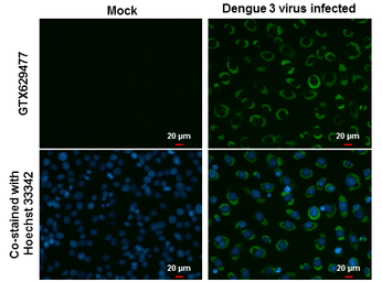 Anti-Dengue virus NS3 protein antibody [GT2811] used in Immunocytochemistry/ Immunofluorescence (ICC/IF). GTX629477