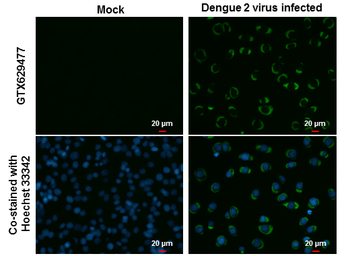 Anti-Dengue virus NS3 protein antibody [GT2811] used in Immunocytochemistry/ Immunofluorescence (ICC/IF). GTX629477