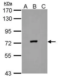 Anti-Dengue virus NS3 protein antibody [GT2811] used in Western Blot (WB). GTX629477