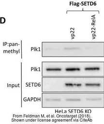 Anti-SETD6 antibody [GT688] used in Western Blot (WB). GTX629891