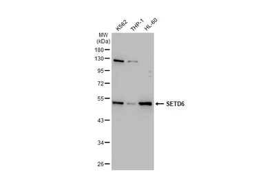 Anti-SETD6 antibody [GT688] used in Western Blot (WB). GTX629891