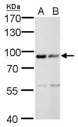 Anti-Calnexin antibody [GT1563] used in Western Blot (WB). GTX629976