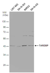 Anti-TDP43 antibody [GT225] used in Western Blot (WB). GTX630196