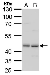 Anti-TDP43 antibody [GT225] used in Western Blot (WB). GTX630196