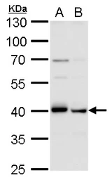 Anti-TDP43 antibody [GT225] used in Western Blot (WB). GTX630196