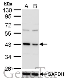 Anti-TDP43 antibody [GT225] used in Western Blot (WB). GTX630196