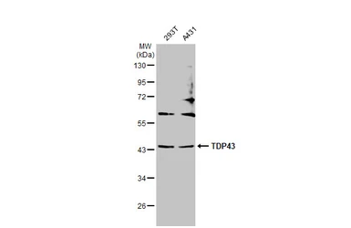 Anti-TDP43 antibody [GT225] used in Western Blot (WB). GTX630196