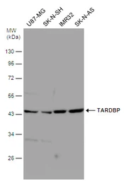 Anti-TDP43 antibody [GT733] used in Western Blot (WB). GTX630197