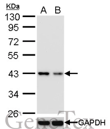 Anti-TDP43 antibody [GT733] used in Western Blot (WB). GTX630197