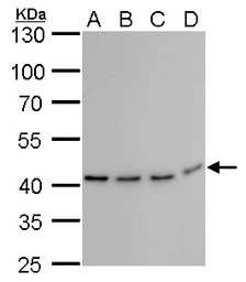 Anti-TDP43 antibody [GT733] used in Western Blot (WB). GTX630197