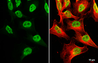 Anti-TDP43 antibody [GT733] used in Immunocytochemistry/ Immunofluorescence (ICC/IF). GTX630197