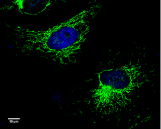 Anti-UQCRC1 antibody [GT139] used in Immunocytochemistry/ Immunofluorescence (ICC/IF). GTX630413