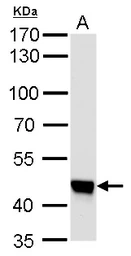 Anti-UQCRC1 antibody [GT139] used in Western Blot (WB). GTX630413