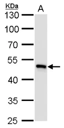 Anti-UQCRC1 antibody [GT139] used in Western Blot (WB). GTX630413