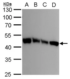 Anti-UQCRC1 antibody [GT139] used in Western Blot (WB). GTX630413