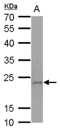 Anti-SOD2 antibody [GT1433] used in Western Blot (WB). GTX630559