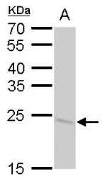 Anti-SOD2 antibody [GT1433] used in Western Blot (WB). GTX630559