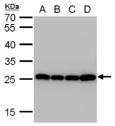 Anti-SOD2 antibody [GT1433] used in Western Blot (WB). GTX630559