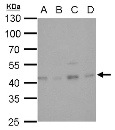 Anti-Glutamine synthetase antibody [GT1055] used in Western Blot (WB). GTX630654