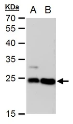 Anti-LIN7A antibody [GT377] used in Western Blot (WB). GTX631106