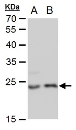 Anti-LIN7A antibody [GT879] used in Western Blot (WB). GTX631107