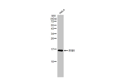 Anti-FIS1 antibody [GT9810] used in Western Blot (WB). GTX631209