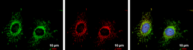 Anti-FIS1 antibody [GT9810] used in Immunocytochemistry/ Immunofluorescence (ICC/IF). GTX631209