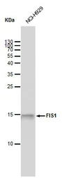 Anti-FIS1 antibody [GT9810] used in Western Blot (WB). GTX631209