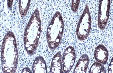 Anti-MCT1 antibody [GT14612] used in IHC (Paraffin sections) (IHC-P). GTX631643