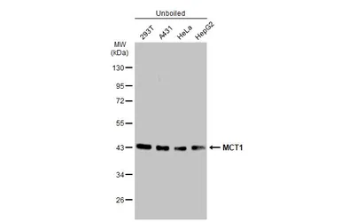 Anti-MCT1 antibody [GT14612] used in Western Blot (WB). GTX631643