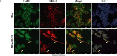 Anti-beta Tubulin 3/ Tuj1 antibody [GT11710] used in Immunocytochemistry/ Immunofluorescence (ICC/IF). GTX631836