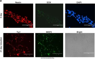 Anti-beta Tubulin 3/ Tuj1 antibody [GT11710] used in Immunocytochemistry/ Immunofluorescence (ICC/IF). GTX631836