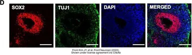 Anti-beta Tubulin 3/ Tuj1 antibody [GT11710] used in IHC (Frozen sections) (IHC-Fr). GTX631836