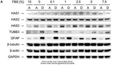 Anti-beta Tubulin 3/ Tuj1 antibody [GT11710] used in Western Blot (WB). GTX631836