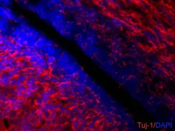 Anti-beta Tubulin 3/ Tuj1 antibody [GT11710] used in IHC (Frozen sections) (IHC-Fr). GTX631836