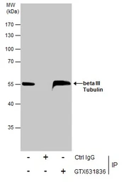 Anti-beta Tubulin 3/ Tuj1 antibody [GT11710] used in Immunoprecipitation (IP). GTX631836