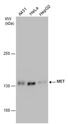 Anti-c-Met antibody [GT556] used in Western Blot (WB). GTX631992