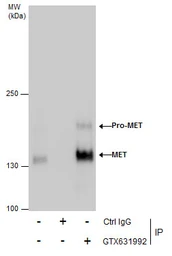 Anti-c-Met antibody [GT556] used in Immunoprecipitation (IP). GTX631992