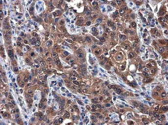 Anti-c-Met antibody [GT556] used in IHC (Paraffin sections) (IHC-P). GTX631992