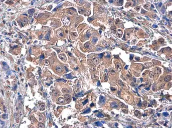 Anti-c-Met antibody [GT556] used in IHC (Paraffin sections) (IHC-P). GTX631992