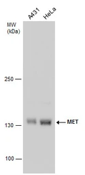 Anti-c-Met antibody [GT1586] used in Western Blot (WB). GTX631993