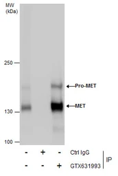 Anti-c-Met antibody [GT1586] used in Immunoprecipitation (IP). GTX631993