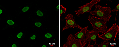 Anti-Histone H4K16ac (Acetyl Lys16) antibody [GT1271] used in Immunocytochemistry/ Immunofluorescence (ICC/IF). GTX632067