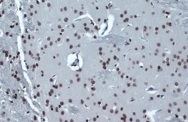 Anti-Histone H4K16ac (Acetyl Lys16) antibody [GT1271] used in IHC (Paraffin sections) (IHC-P). GTX632067