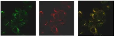 Anti-SNX27 antibody [1C6] used in Immunocytochemistry/ Immunofluorescence (ICC/IF). GTX632193