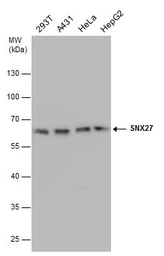 Anti-SNX27 antibody [1C6] used in Western Blot (WB). GTX632193