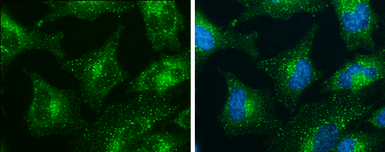 Anti-SNX27 antibody [1C6] used in Immunocytochemistry/ Immunofluorescence (ICC/IF). GTX632193