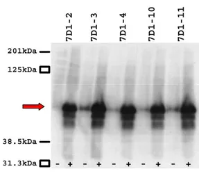 Anti-CACNB3 antibody [7D1] used in Western Blot (WB). GTX632268