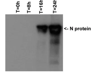 Anti-SARS-CoV / SARS-CoV-2 (COVID-19) Nucleocapsid antibody [6H3] used in Western Blot (WB). GTX632269