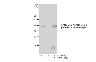 Anti-SARS-CoV / SARS-CoV-2 (COVID-19) Nucleocapsid antibody [6H3] used in Immunoprecipitation (IP). GTX632269